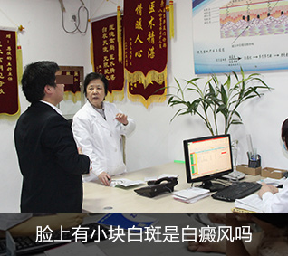 白癜风治疗